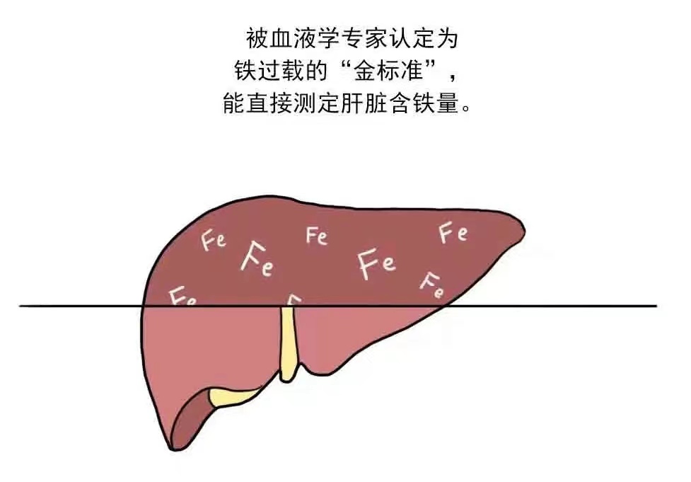 骨髓增生异常综合征(MDS)铁过载的检查方法