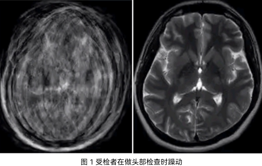 影像科 新技术临床应用周刊第8季