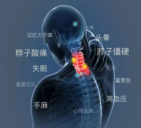 颈椎如何保养？