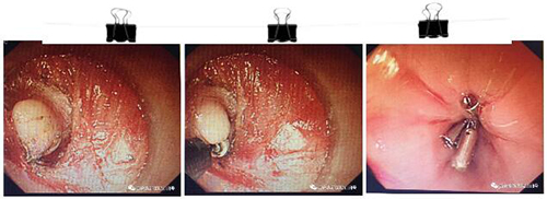 1527329815119542.jpg 201711030848573275.jpg