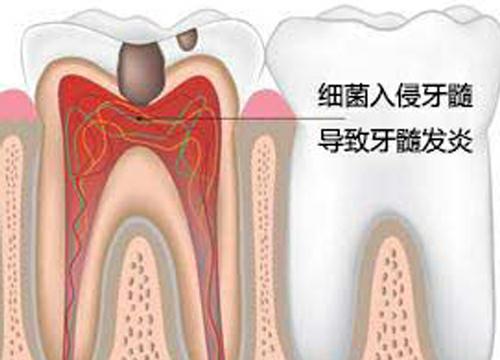 10-1G1231A611533.jpg