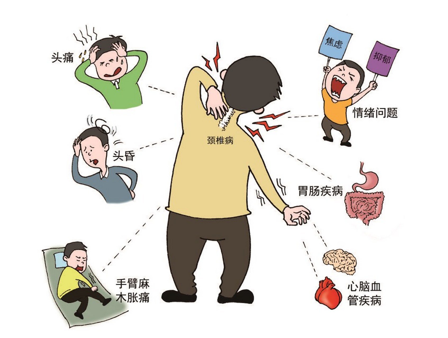 颈椎轻微不适，如何正确缓解？